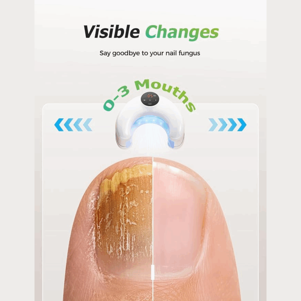 Welnax Bioclear (upgraded Version) - Official Retailer